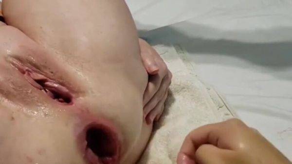 Bbw fisting mature slut - upornia.com on v0d.com