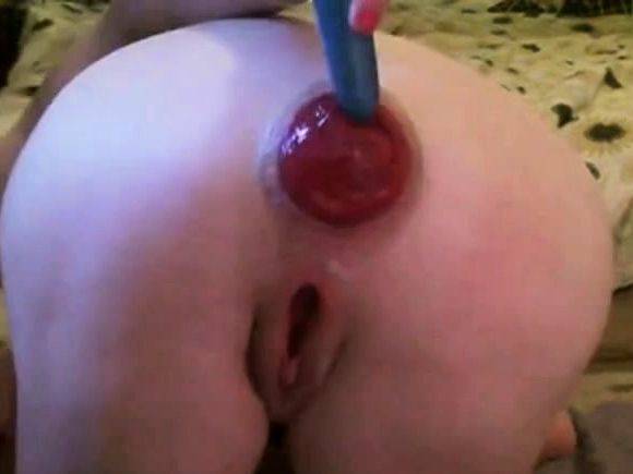 PROLAPSE-A-LICIOUS 2 - drtuber.com on v0d.com
