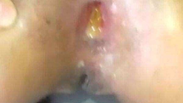 Daddy Stretches Teen's Big Ass Wide Open - Rough Anal Sex with Colombian Culona - xxxfiles.com - Colombia on v0d.com